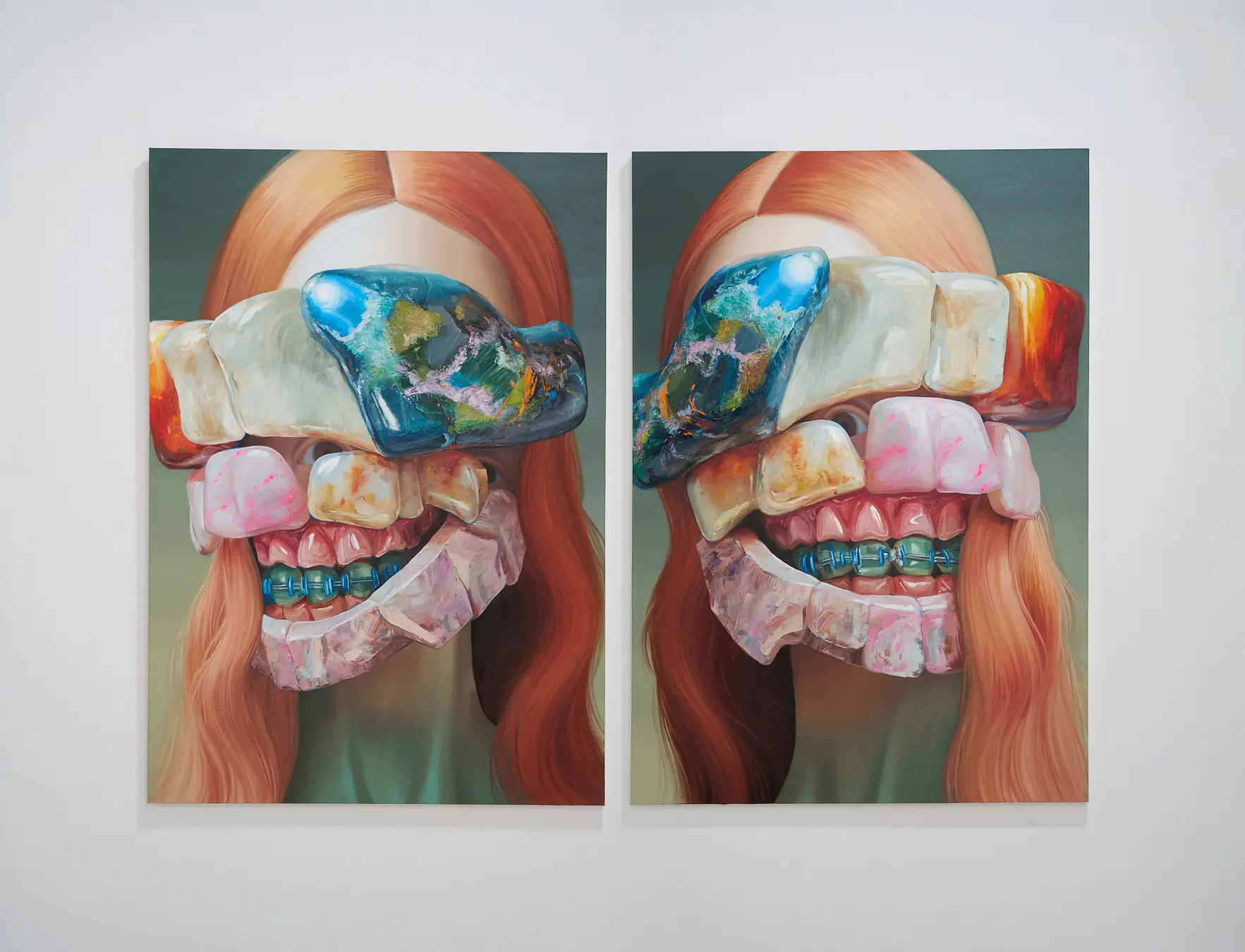 ELM - Horacio Quiroz